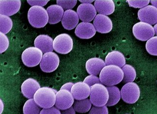 استافیلوکوکوس اورئوس