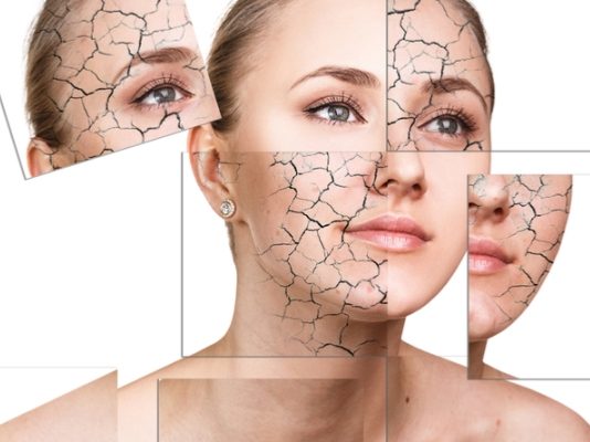 پوست خشک چیست ؟