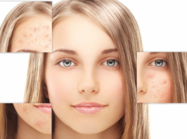 پوست حساس چیست؟