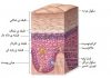 لایه شاخی / استراتوم کورنئوم/Stratum corneum